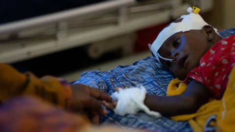 Fatima Abdullah mengulurkan tangan untuk menyentuh putrinya yang berusia 8 bulan, Abdi, yang dirawat di rumah sakit karena kekurangan gizi parah di Somalia pada bulan Juli.